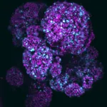 Researchers create a new organoid with all key pancreas cells