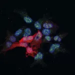 Researchers decipher the mechanism by which the MAF protein promotes breast cancer metastasis