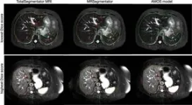 Researchers develop AI model to automatically segment MRI images 2