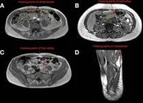 Researchers develop AI model to automatically segment MRI images 3