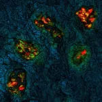 Researchers develop innovative technique for distinguishing tumor from normal tissue