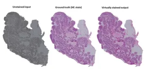 Researchers developed an AI-based method to replace chemical staining of tissue