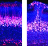 Researchers discover a new embryonic brain circuit