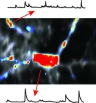 Researchers discover a new embryonic brain circuit 2