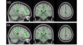 Researchers explore the neurobiological basis of child abuse by maltreating mothers