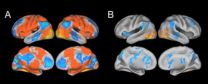 Researchers find neural compensation in people with Alzheimers-related protein