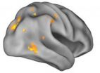 Researchers find neural compensation in people with Alzheimer's-related protein 2