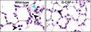 Researchers find promising candidate to treat irreversible lung and eye diseases in extremely premature infants