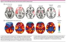 Researchers identify a brain circuit for creativity 2