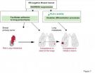 Researchers identify a new suppressor of breast metastasis to the lung