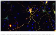 Researchers identify a potential new therapeutic target in Parkinson’s disease 3