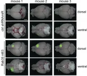 Researchers link cellular transport pathway to aggressive brain cancer