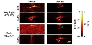 Researchers shed light on skin tone bias in breast cancer imaging