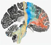 Researchers use deep brain stimulation to map therapeutic targets for four brain disorders