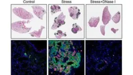 Researchers use deep brain stimulation to map therapeutic targets for four brain disorders 2