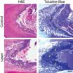 Researchers use light to coax stem cells to repair teeth