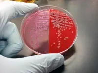 Resistant E. coli rises despite drop in ciprofloxacin use