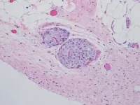 Restoring our ubiquitination machinery to overcome resistance to cancer therapy 2