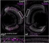 Rice fish model of a rare metabolic disorder