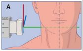 Robotic-assisted imaging: from trans-Atlantic evaluation to help in daily practice 2