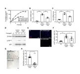 Roles of PEDF in exercise-induced suppression of senescence and its impact on lung pathology in mice