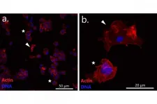 Russian biologists discover a transmissible cancer lineage in the Far Eastern mussels