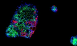 SARS-CoV-2 curtails immune response in the gut