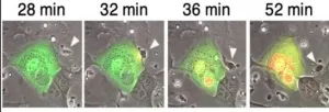 SARS-CoV-2: Infection induces antibodies capable of killing infected cells