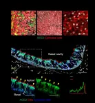 SARS-CoV-2 replication targets nasal ciliated cells early in COVID-19 infection