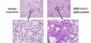 SARS-CoV-2 spike protein alone may cause lung damage