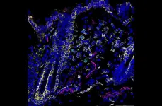 Scientific discovery scratching beneath the surface of itchiness