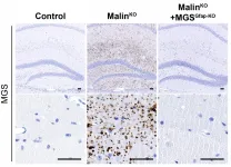 Scientists at IRB Barcelona discover the cause of neurodegeneration in Lafora disease