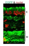 Scientists demonstrate promising new approach for treating cystic fibrosis