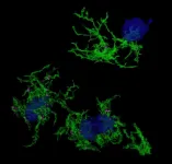 Scientists discover gene signature for plaque-eating microglia in Alzheimers Disease