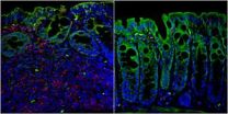 Scientists discover pain receptor on T-cells