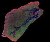 Scientists discover pathway that activates brown fat