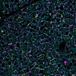 Scientists discover pathway that activates brown fat 3