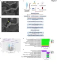 Scientists discover potential cause of an enigmatic vascular disease primarily impacting women