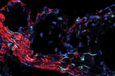 Scientists find genetic link to clogged arteries