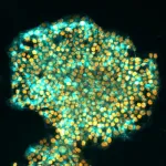 Scientists find way to wipe a cell’s memory to better reprogram it as a stem cell