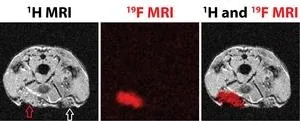 Scientists from IOCB Prague have improved materials for reconstructive and plastic surgery 2