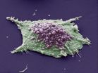 Scientists pinpoint protein that could improve small cell lung cancer therapies