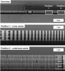 Sharper imaging using X-rays