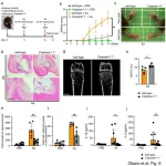 Shedding light on how oral bacteria can aggravate rheumatoid arthritis