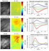 Shedding new light on infant brain development