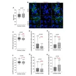 Short telomeres in alveolar type II cells associate with lung fibrosis in post COVID-19 patients with cancer