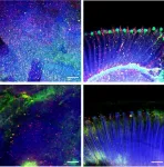 Signals from muscle protect from dementia