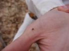 Single tick bite can pack double pathogen punch