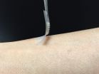 Smart insulin patch could replace painful injections for diabetes