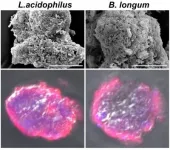 Smectite promotes probiotic biofilm formation in gut for cancer immunotherapy